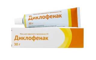 Лечение растяжения связок в домашних условиях: методы и средства