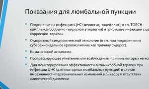 Люмбальная пункция: техника выполнения