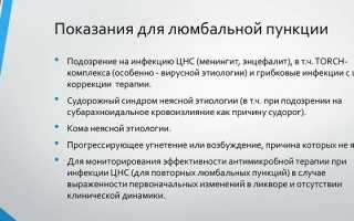 Люмбальная пункция: техника выполнения