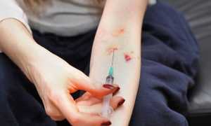 Признаки гепатита — причины, проявление и виды заболевания, диагностика, методы терапии и осложнения