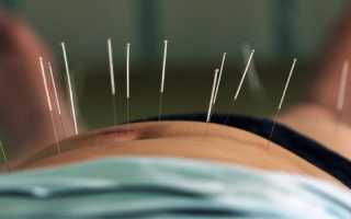 Лечение калькулезного холецистита хирургически, медикаментозно, диетой