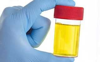 Моча на диастазу — как сдавать и расшифровка результатов, нормальные показатели для детей и взрослых