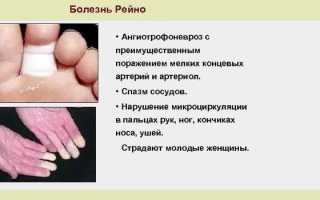 Почему мерзнут ноги даже в тепле