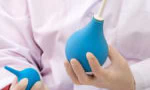 Медикаментозное лечение хронического кандидоза у женщин