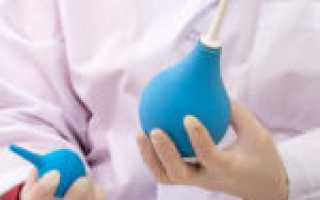 Медикаментозное лечение хронического кандидоза у женщин