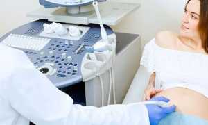 Диагностика внематочной беременности — симптомы и признаки патологии, основные исследования