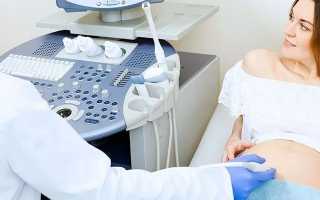 Диагностика внематочной беременности — симптомы и признаки патологии, основные исследования