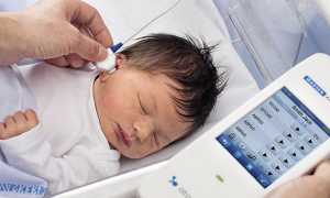 Скрининг новорожденных: сроки и результаты