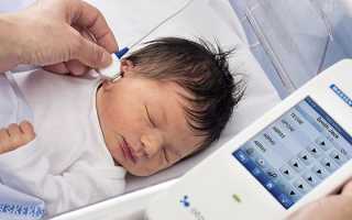 Скрининг новорожденных: сроки и результаты