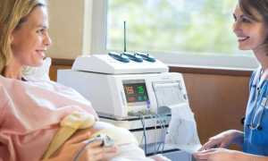 Видны ли схватки на КТГ?