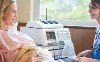 Видны ли схватки на КТГ?