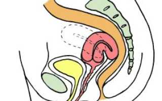 Необходим ли аборт при загибе матки?