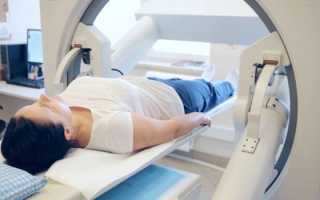 Сцинтиграфия костей скелета — как проводят изотопное исследование