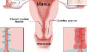 Разбираемся в особенностях психосоматики молочницы