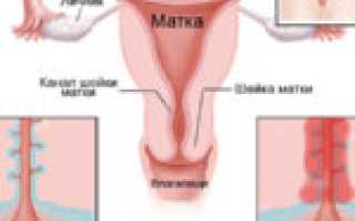 Разбираемся в особенностях психосоматики молочницы