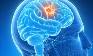 Болезни головного мозга у человека — симптомы и признаки, диагностика, методы лечения и профилактика