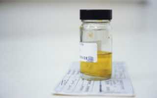 Причины возникновения и способы лечения грибка у беременных