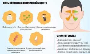 Заразен ли гайморит для окружающих детей и взрослых