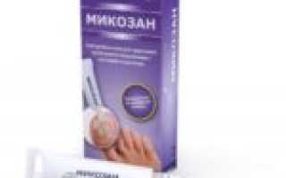 Препараты и процедуры для профилактики грибка ногтей на ногах