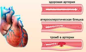 УЗИ сосудов нижних конечностей — подготовка и порядок проведения