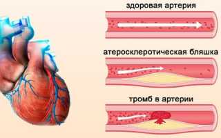 УЗИ сосудов нижних конечностей — подготовка и порядок проведения
