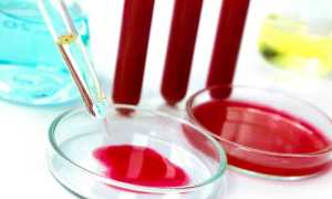 Все об ушном псориазе — особенности заболевания и его лечение