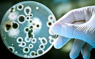 Посев мочи определение и расшифровка