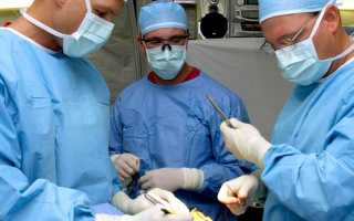 Трахеостома – что это такое: алгоритм ухода