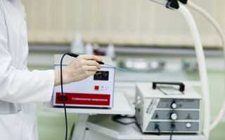 Радиоволновая коагуляция шейки матки: подробное описание процедуры