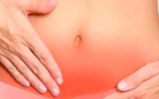 Свечи от кисты яичника