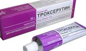 Кефалогематома у новорожденных — причины возникновения, виды и локализация, методы лечения и удаления