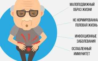 Хронический бактериальный простатит у мужчин — симптомы, диагностика и лечение