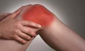 Мазь от артроза коленного сустава