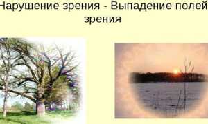 Восстановление зрения после инсульта — причины нарушений, выпадение полей, методы и способы лечения
