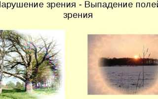 Восстановление зрения после инсульта — причины нарушений, выпадение полей, методы и способы лечения