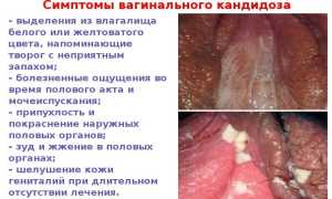 Грибок кандида — симптомы и причины у мужчин, женщин и детей, диагностика, способы терапии и профилактика