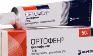 Киста Бейкера