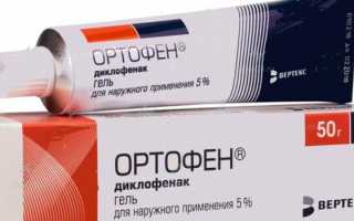 Киста Бейкера