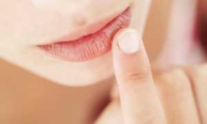 Почему появляется грибок на губах и как нужно с ним бороться