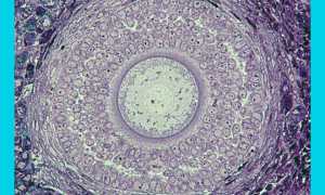 Когда доминантного фолликула нет: почему и что делать