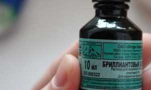 Ветряная оспа у детей — пути заражения, инкубационных период, симптомы, методы лечения и профилактика