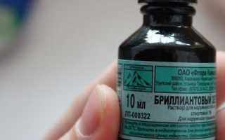 Ветряная оспа у детей — пути заражения, инкубационных период, симптомы, методы лечения и профилактика