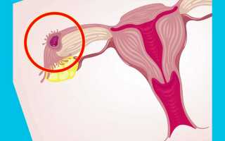 Гистерэктомия: можно ли забеременеть без матки