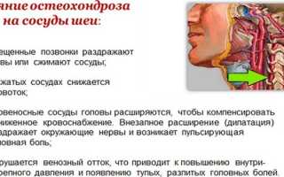 УЗИ позвоночника — когда назначают и что показывает