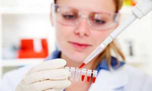 Анализ ПЦР на паразитов