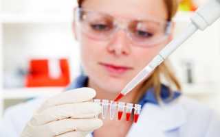 Анализ ПЦР на паразитов