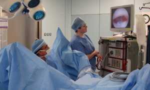 Гистероскопия матки что это