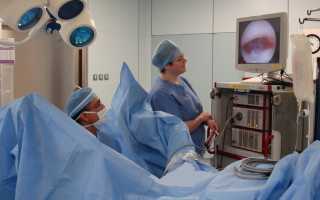 Гистероскопия матки что это