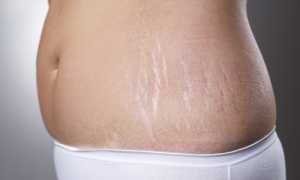 Действенные упражнения, которые помогут восстановить форму после родов