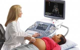 Доплерометрия. Что это и зачем нужно?